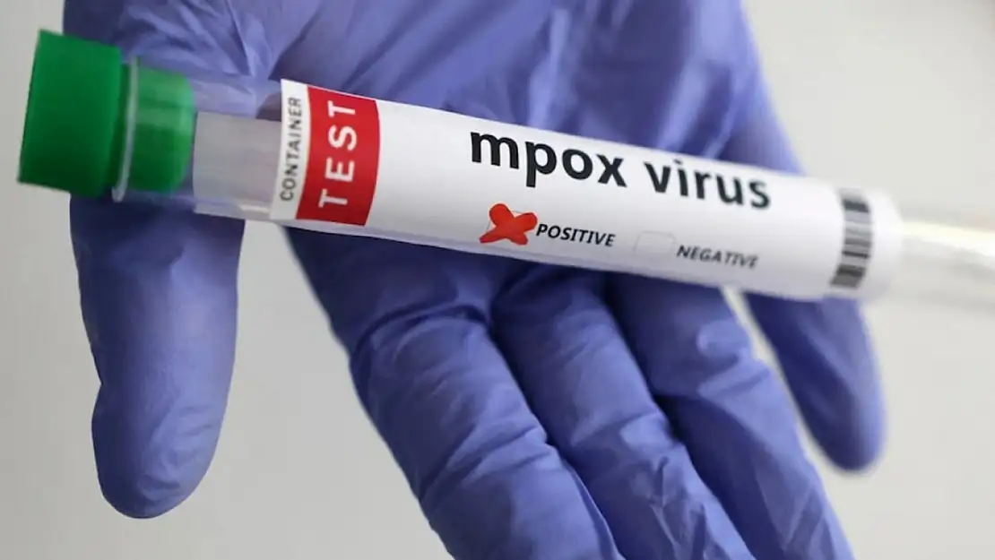 DSÖ: Mpox Artık Küresel Sağlık Acil Durumu Değil
