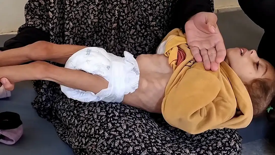 Gazze'de açlıktan ölen çocukların sayısı 66'ya yükseldi