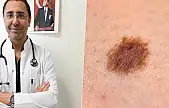 Uzmandan cilt kanseri uyarısı