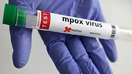 DSÖ: Mpox Artık Küresel Sağlık Acil Durumu Değil