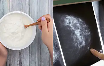 Araştırmacılardan meme kanserine ilişkin yeni hipotez: Zararlı bakteriler iltihaplanmayı tetikliyor olabilir
