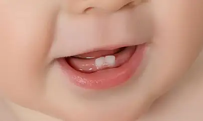 Diş çıkarma döneminde dikkat edilmesi gerekenler
