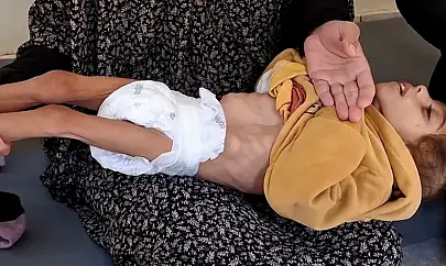 Gazze'de açlıktan ölen çocukların sayısı 66'ya yükseldi