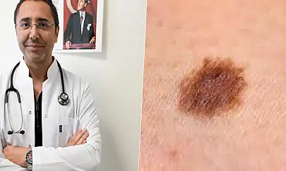 Uzmandan cilt kanseri uyarısı