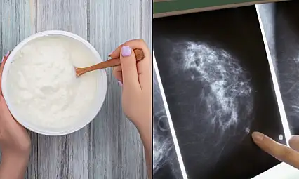 Araştırmacılardan meme kanserine ilişkin yeni hipotez: Zararlı bakteriler iltihaplanmayı tetikliyor olabilir