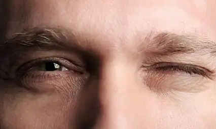 Göz seğirmesi masum mu hastalık habercisi mi?
