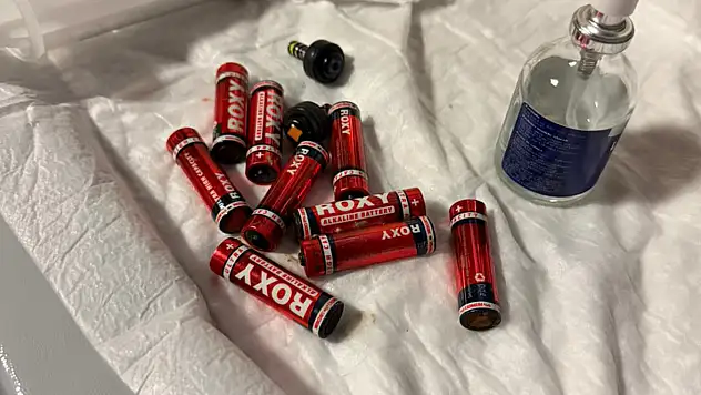 Doğubayazıt'ta Şoke Eden Vaka: Midesinden 9 Pil, 3 Jilet Çıkarıldı