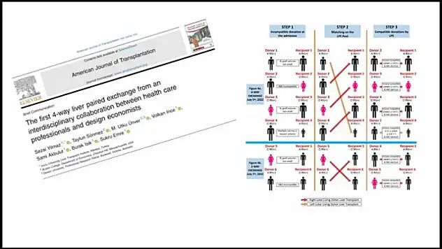 En ileri çapraz karaciğer nakli modeli dünya basınında