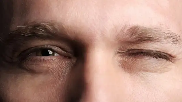 Göz seğirmesi masum mu hastalık habercisi mi?