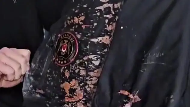 İstanbul'da polise asitli saldırı: 323 gözaltı