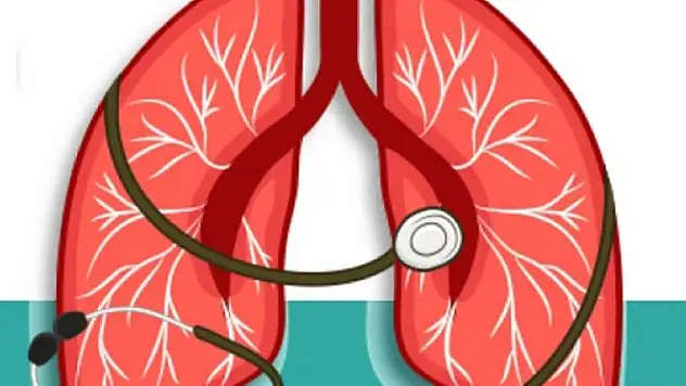 Verem Sağlığımızı  Tehdit Ediyor