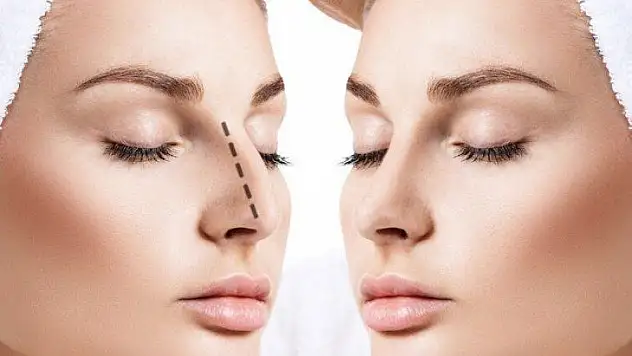 Op. Dr. Diren Çelik: Burun Estetiğinde 10 Maddeye Dikkat Çekti !