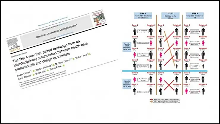 En ileri çapraz karaciğer nakli modeli dünya basınında