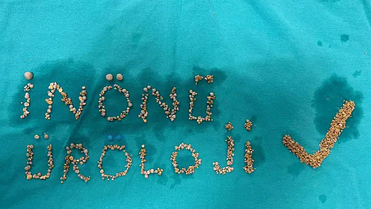 İnönü Üniversitesi Tıp Merkezi'nde sıra dışı operasyon: 200 taş çıkarıldı, kanser cerrahisi yapıldı