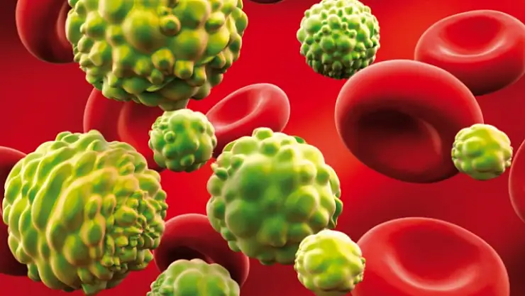 Her Altı Kişiden Biri Kanserden Ölüyor