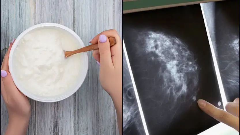 Araştırmacılardan meme kanserine ilişkin yeni hipotez: Zararlı bakteriler iltihaplanmayı tetikliyor olabilir