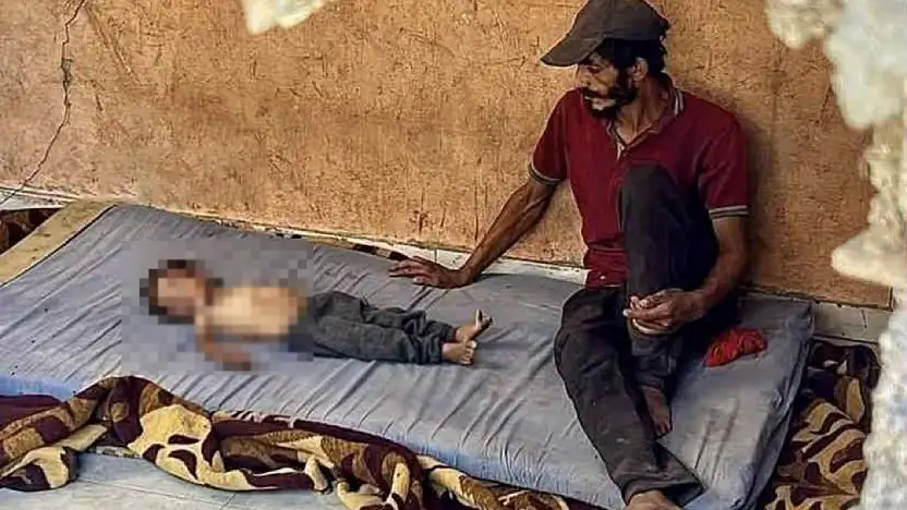 Gazze'de açlıktan şehit sayısı 124'e yükseldi