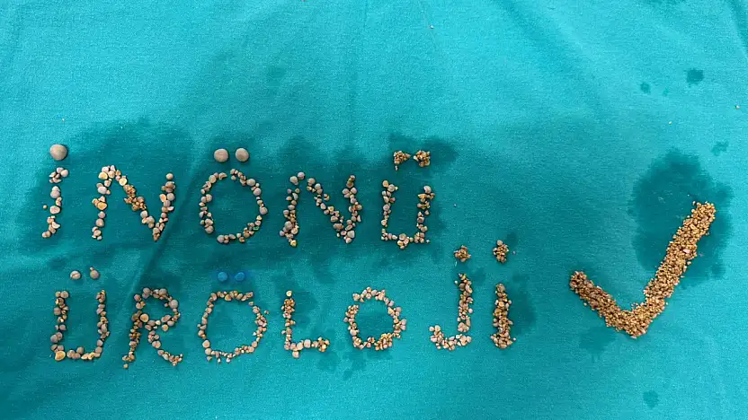 İnönü Üniversitesi Tıp Merkezi'nde sıra dışı operasyon: 200 taş çıkarıldı, kanser cerrahisi yapıldı