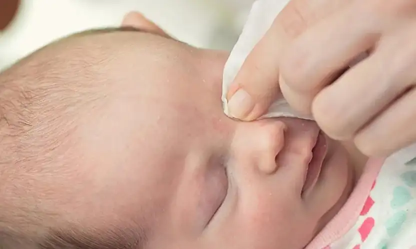 Bebek ve çocuklarda göz sulanması tedavisi