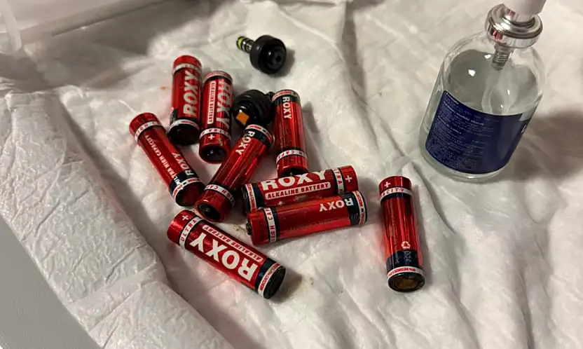 Doğubayazıt'ta Şoke Eden Vaka: Midesinden 9 Pil, 3 Jilet Çıkarıldı