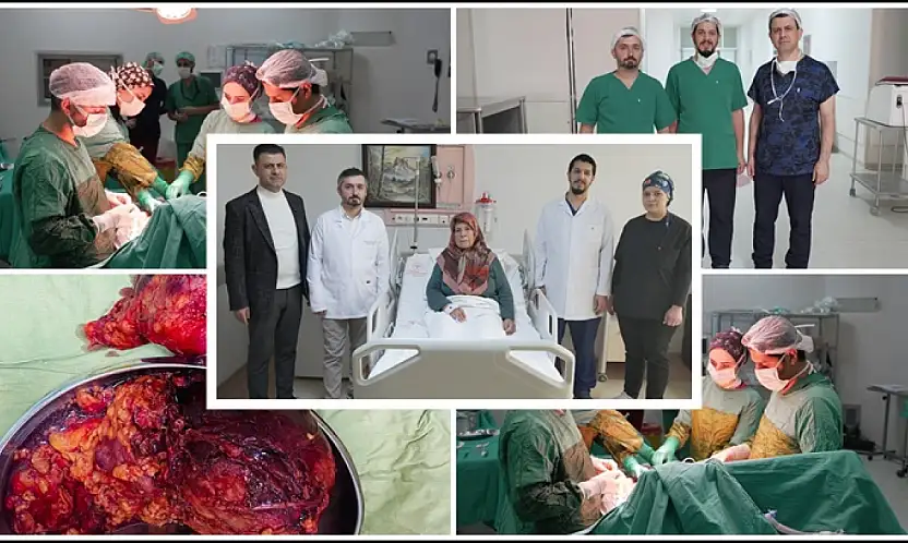 MEAH'ta Dev Tümör Operasyonu: 2 Kilo 200 Gramlık Kitle Başarıyla Çıkarıldı
